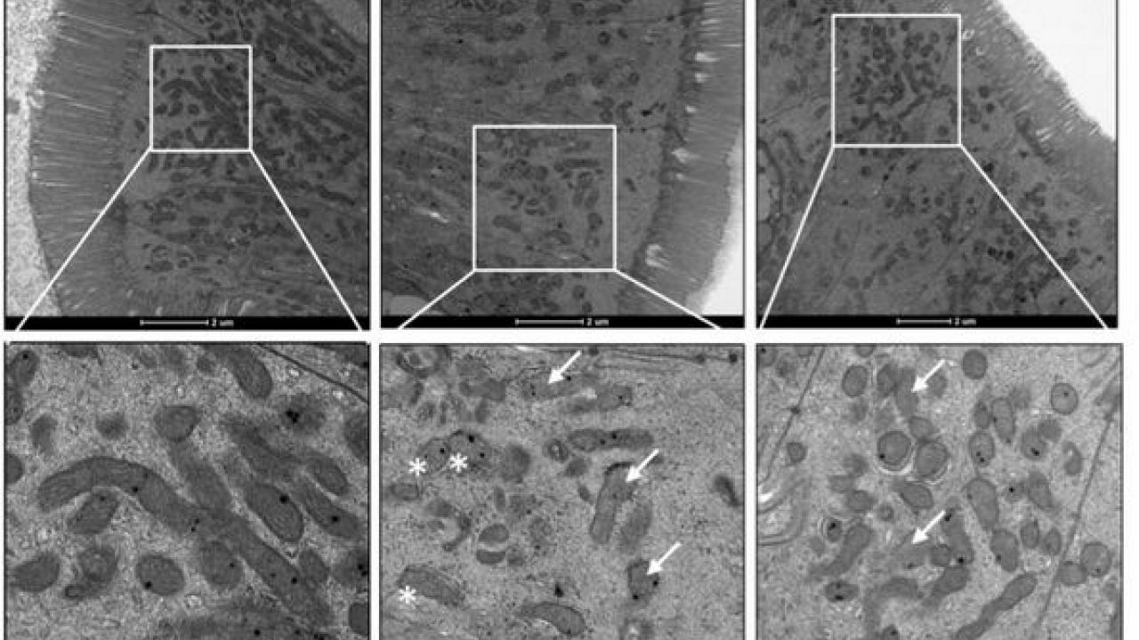 Protective effects of L. plantarum on mitochondrial structure and density in SIV-infected gut. Microscopic images showing protective effects of L. plantarum on mitochondrial structure and density in SIV-infected gut.