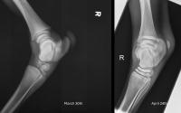 Two-panel right elbow X-rays, lateral and AP views of humerus, radius, and ulna
