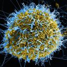 ebola virus