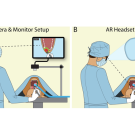 Diagram: surgeon viewing laparoscopic monitor (left) and using AR headset with overlay (right)
